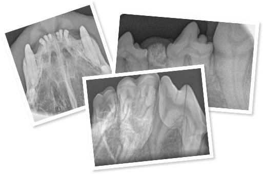 dentals